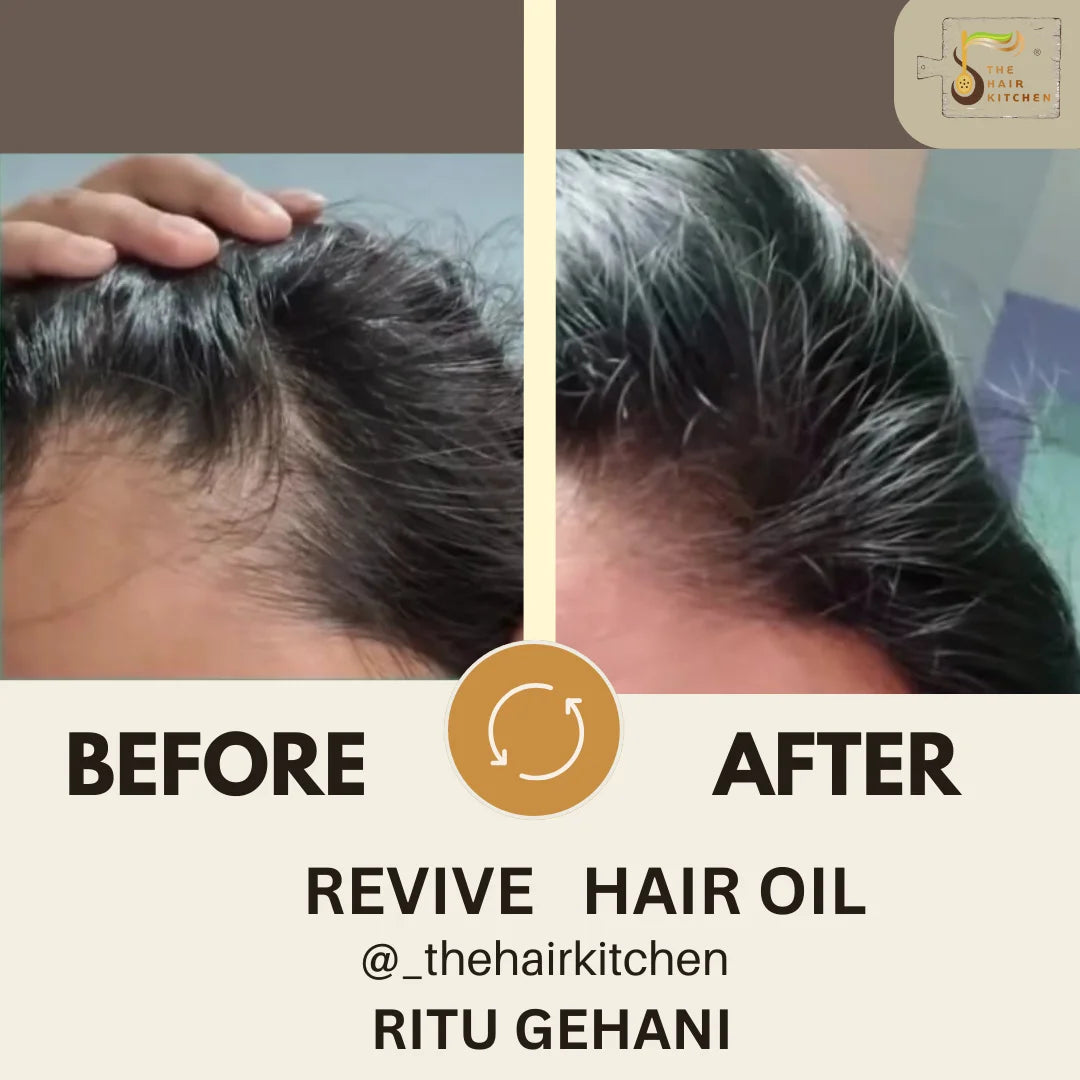 REVIVE HAIR OIL  (30ml / 120ml)